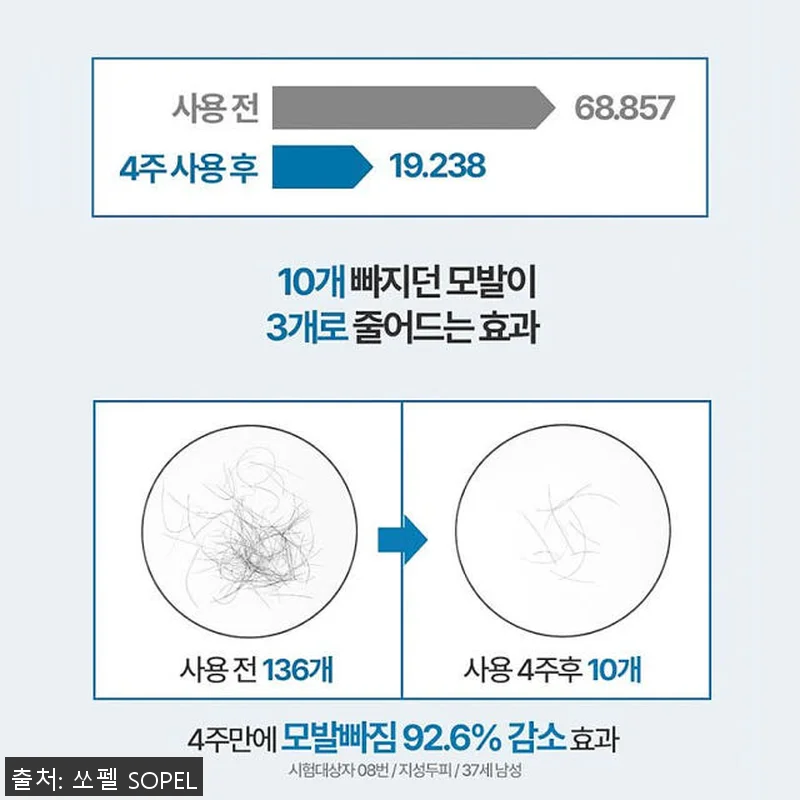 쏘펠 블로커12 남자 탈모앰플 사용후 관련 이미지 3