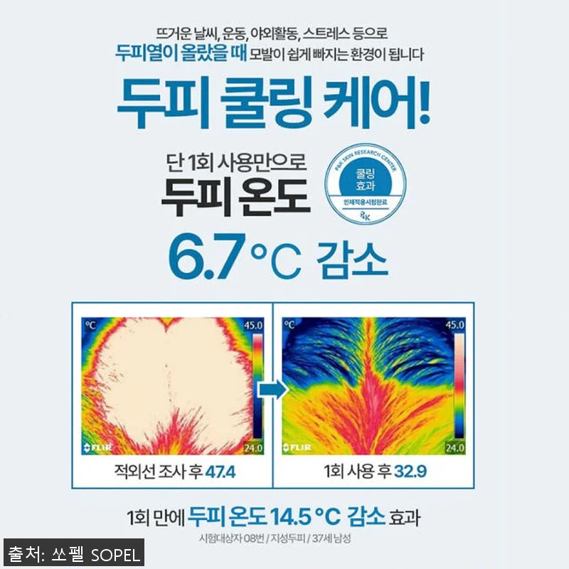 쏘펠 블로커12 남자 탈모앰플 사용후 관련 이미지 4