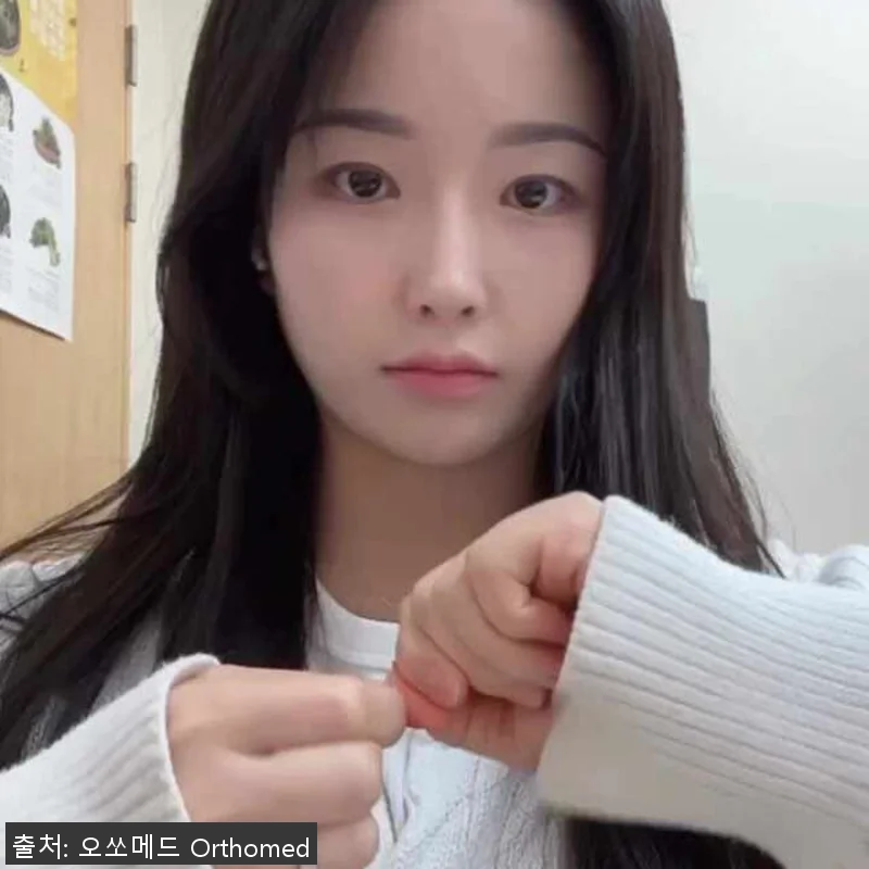 베리마노스 크랜베리 질유산균 람노서스 관련 이미지 4